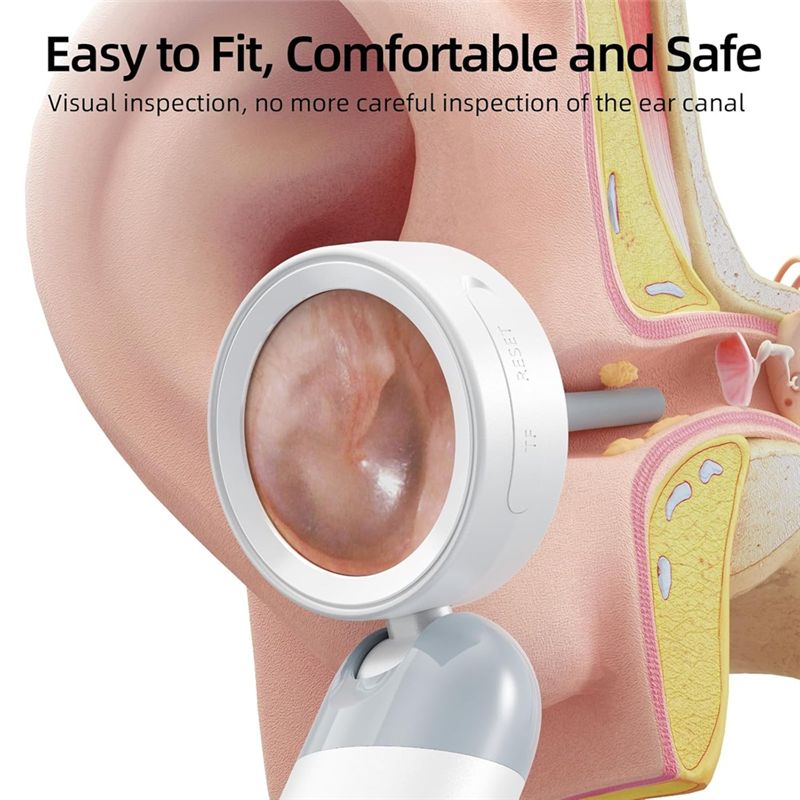 LXYB18B Wireless Ear Otoscope  - Macro Photography Led Lighting review and price