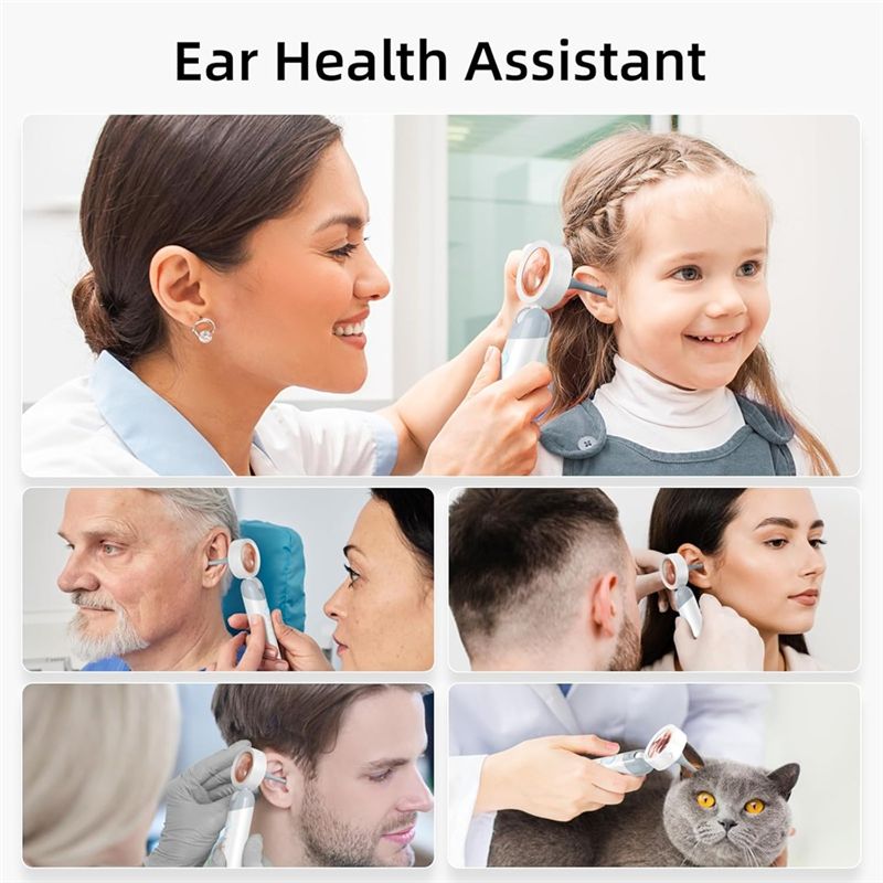 LXYB18B Wireless Ear Otoscope  - Macro Photography Led Lighting review and price