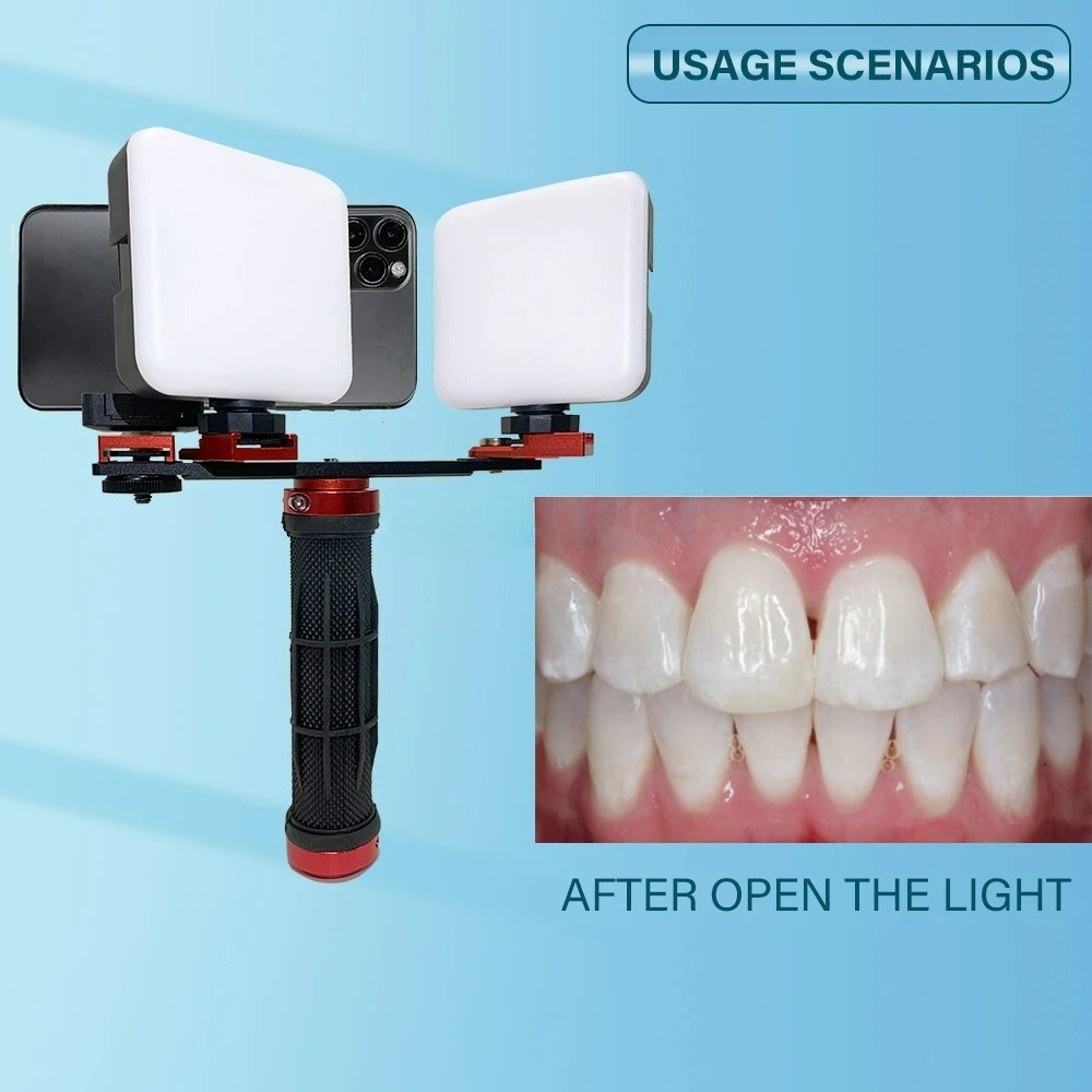 Dental Photography Light Phone - Photography Lighting Accessories review and price