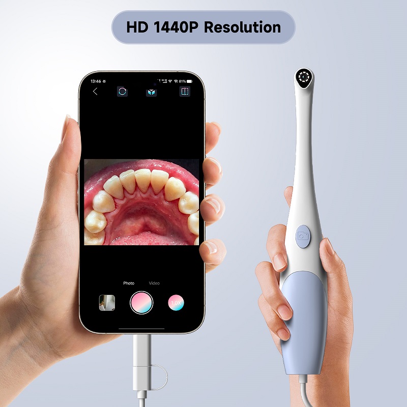 Oral Endoscope Camera 1440P Ph - Photography Lighting Continuous review and price
