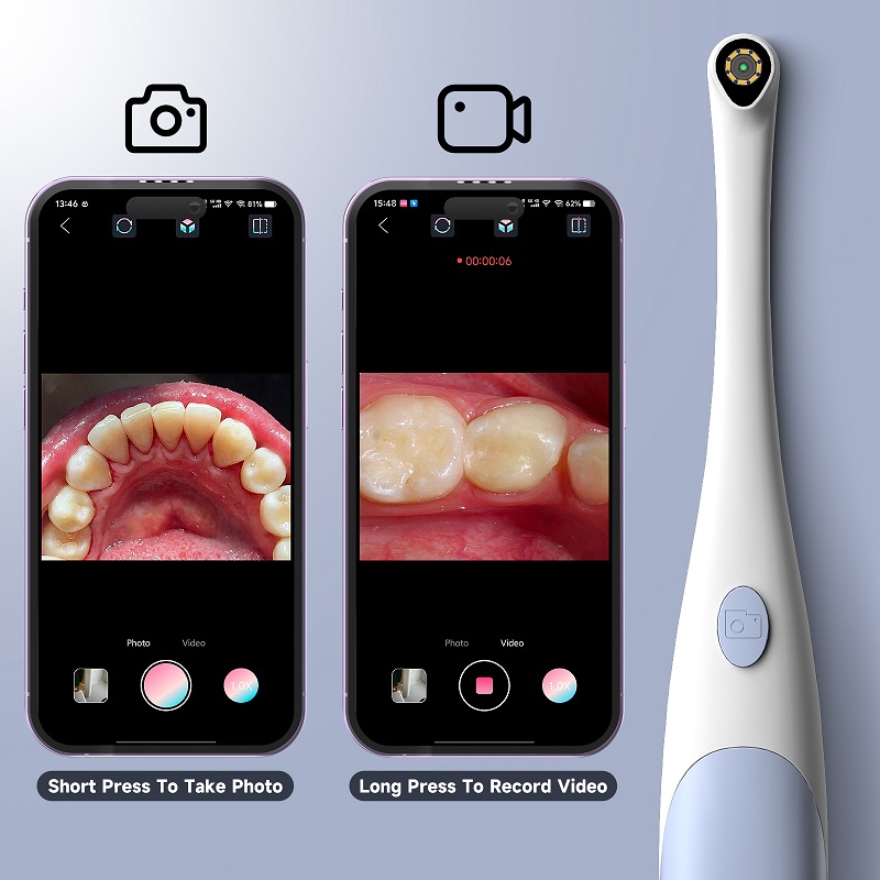 Oral Endoscope Camera 1440P Ph - Photography Lighting Continuous review and price